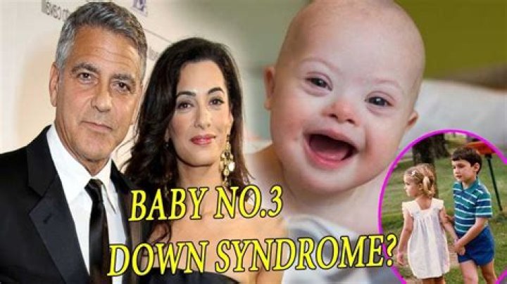 Does George Clooney Have A Child Diagnosed With Down Syndrome?