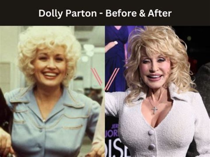 Uncover The Truth: Are Dolly Parton's Breasts Enhanced Or Natural?
