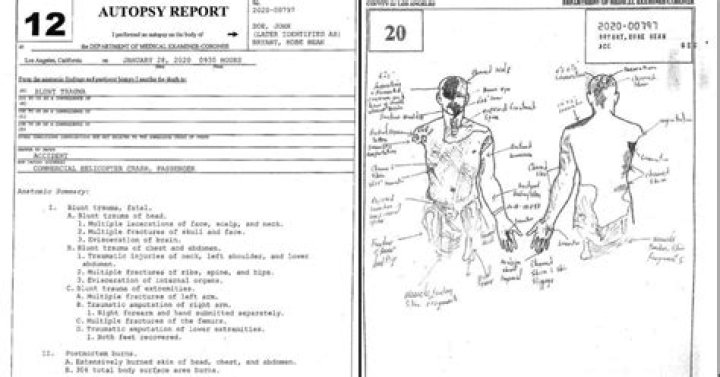 Uncovering The Truth: Gianna Bryant Autopsy Findings