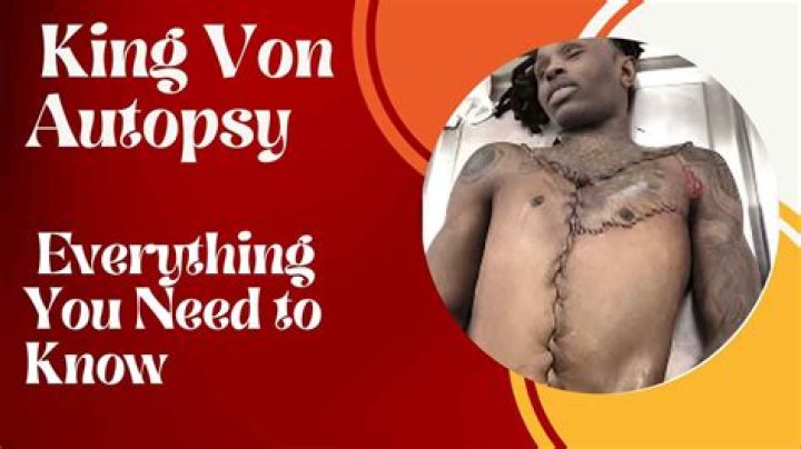 Was King Von's Autopsy Report Authentic? Unraveling The Truth